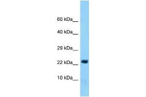 Western Blotting (WB) image for anti-Histidine Triad Nucleotide Binding Protein 2 (HINT2) (Middle Region) antibody (ABIN2788383)