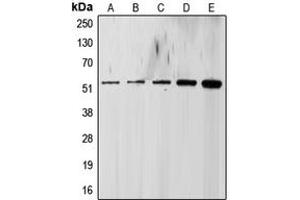 Western Blotting (WB) image for anti-Transforming Growth Factor, beta Receptor 1 (TGFBR1) (Center) antibody (ABIN7297130)