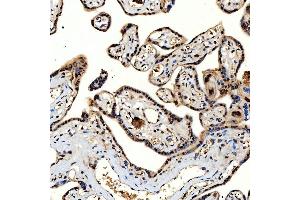 IHC analysis of SNRNP40 using anti-SNRNP40 antibody (ABIN7601719).