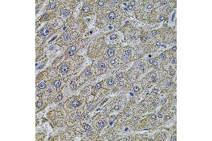Immunohistochemistry of paraffin-embedded human liver injury using MAP1B antibody (ABIN5971696) at dilution of 1/100 (40x lens).