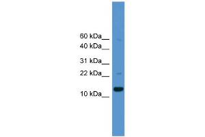 WB Suggested Anti-CASP1 Antibody Titration: 0. (Caspase 1 antibody  (Middle Region))