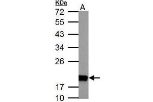 WB Image NDUFS4 antibody detects NDUFS4 protein by Western blot analysis. (NDUFS4 antibody  (Center))