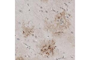 Immunohistochemical staining of human hippocampus with PLEKHF1 polyclonal antibody  shows strong cytoplasmic positivity in astrocyte-like cells.