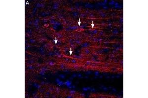 Expression of CXCR4 in rat brain - Immunohistochemical staining of rat temporal cortex using Anti-CXCR4 (extracellular) Antibody (ABIN7043040, ABIN7044166 and ABIN7044167), (1:400) followed by donkey anti-rabbit-biotin and streptavidin labeled with Cy3. (CXCR4 antibody  (Extracellular))