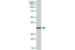 SULT1A1 antibody  (AA 1-295)