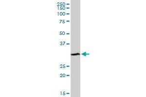 SULT1A1 antibody  (AA 1-295)