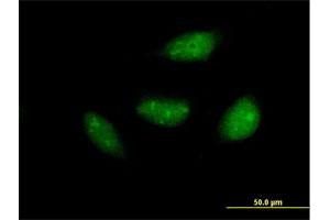 Immunofluorescence of purified MaxPab antibody to NOL6 on HeLa cell. (Nucleolar Protein 6 antibody  (AA 1-200))