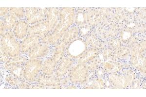 Detection of C8g in Human Kidney Tissue using Polyclonal Antibody to Complement Component 8g (C8g) (C8G antibody  (AA 39-202))