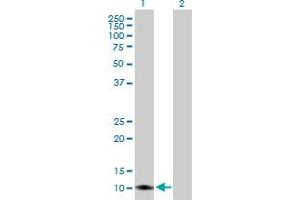 Western Blot analysis of TIMM8A expression in transfected 293T cell line by TIMM8A MaxPab polyclonal antibody. (TIMM8A/DDP antibody  (AA 1-97))