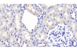 Detection of AGT in Rat Kidney Tissue using Polyclonal Antibody to Angiotensinogen (AGT) (AGT antibody  (AA 25-477))