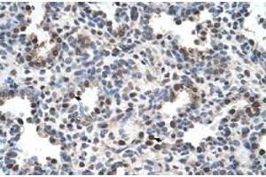 Immunohistochemical staining (Formalin-fixed paraffin-embedded sections) of human lung with FAM134B polyclonal antibody  at 4-8 ug/mL working concentration.
