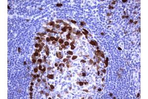 Image no. 2 for anti-Thymidylate Synthetase (TYMS) antibody (ABIN1501589) (TYMS antibody)