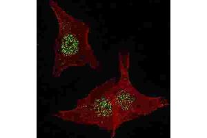 Immunofluorescence (IF) image for anti-Fibroblast Growth Factor Receptor 4 (FGFR4) antibody (ABIN2929142) (FGFR4 antibody)