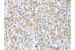 Immunohistochemistry of paraffin-embedded rat ovary using S100A10 antibody (ABIN6290226) at dilution of 1:100 (40x lens).