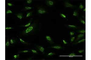 Immunofluorescence of monoclonal antibody to ZBTB25 on HeLa cell. (ZBTB25 antibody  (AA 331-435))