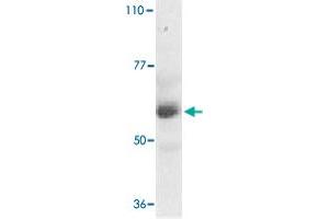 Western blot analysis of TRAF3IP2 expression in human placenta tissue lysate with TRAF3IP2 polyclonal antibody  at 1 ug /mL . (TRAF3IP2 antibody  (AA 554-568))