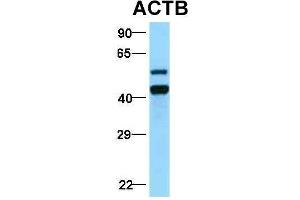 Host:  Rabbit  Target Name:  ACTB  Sample Type:  Human Fetal Lung  Antibody Dilution:  1.