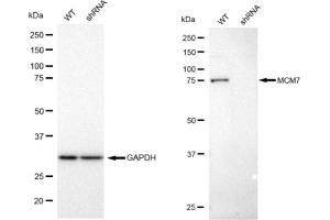Western blotting analysis using MCM7 antibody (ABIN7799423).