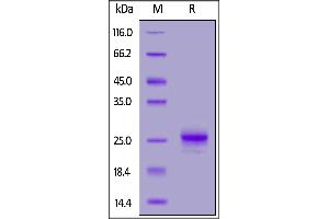 Mouse  1, His Tag on  under reducing (R) condition. (IFNA1 Protein (AA 24-189) (His tag))