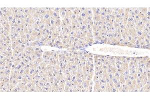 Detection of CHI3L1 in Mouse Liver Tissue using Polyclonal Antibody to Chitinase-3-like Protein 1 (CHI3L1)