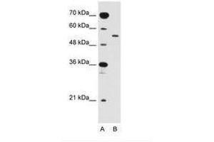 Image no. 1 for anti-Solute Carrier Family 2 (Facilitated Glucose Transporter), Member 10 (SLC2A10) (AA 371-420) antibody (ABIN205022) (SLC2A10 antibody  (AA 371-420))