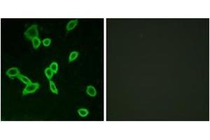 Immunofluorescence analysis of LOVO cells, using LGR6 Antibody. (LGR6 antibody  (AA 471-520))