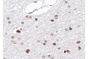 ABIN6269234 at 1/100 staining human brain tissue sections by IHC-P. (BRCA1 antibody  (Internal Region))