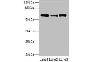 Western blot All lanes: Smox antibody at 3 μg/mL Lane 1: PC-3 whole cell lysate Lane 2: A549 whole cell lysate Lane 3: 293T whole cell lysate Secondary Goat polyclonal to rabbit IgG at 1/10000 dilution Predicted band size: 62, 66, 27, 23, 28, 60, 57, 47, 61, 21 kDa Observed band size: 62 kDa (SMOX antibody  (AA 1-555))