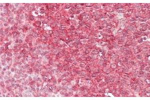 Detection of CAPN1 in Human Tonsil Tissue using Polyclonal Antibody to Calpain 1 (CAPN1) (CAPN1 antibody  (AA 75-343))