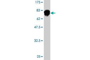 Western Blot detection against Immunogen (74. (Fatty Acid Synthase antibody  (AA 1-439))