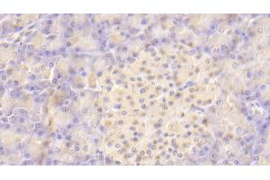 Detection of VTCN1 in Human Pancreas Tissue using Polyclonal Antibody to V-Set Domain Containing T-Cell Activation Inhibitor 1 (VTCN1) (VTCN1 antibody  (AA 34-147))