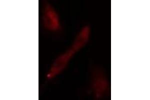 ABIN6275181 staining  293 cells by IF/ICC. (GNL3L antibody)