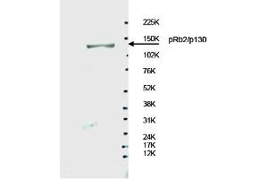 Image no. 1 for anti-Retinoblastoma-Like 2 (p130) (RBL2) antibody (ABIN401457)