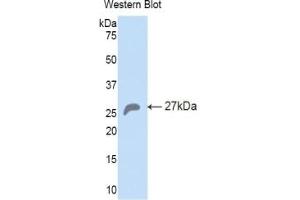 Detection of Recombinant HSPA5, Mouse using Polyclonal Antibody to Heat Shock 70 kDa Protein 5 (HSPA5) (GRP78 antibody  (AA 261-470))