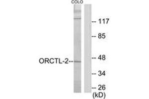 Western blot analysis of extracts from COLO205 cells, using ORCTL-2 Antibody. (ORCTL-2/SLC22A18 antibody  (AA 359-408))