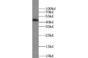 Western blot analysis of human plasma tissue subjected to SDS-PAGE, using ORM2 antibody (1/1000 dilution). (Orosomucoid 2 antibody)