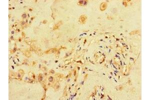 Immunohistochemistry of paraffin-embedded human placenta tissue using ABIN7159100 at dilution of 1:100 (MED1 antibody  (AA 878-1031))