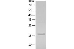 Western Blotting (WB) image for GTPase Kras (KRAS) (AA 1-186) protein (His tag) (ABIN7284851) (K-RAS Protein (AA 1-186) (His tag))