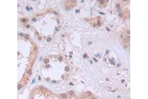 Used in DAB staining on fromalin fixed paraffin- embedded Kidney tissue (KPNB1 antibody  (AA 21-441))
