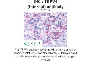 Image no. 1 for anti-Transient Receptor Potential Cation Channel, Subfamily V, Member 4 (TRPV4) (Internal Region) antibody (ABIN1740406) (TRPV4 antibody  (Internal Region))