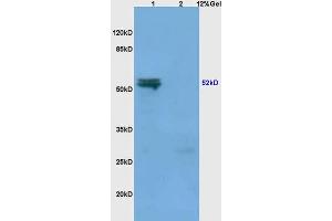 Lane 1: mouse spleen lysates Lane 2: mouse liver lysates probed with Anti MMP-3 Polyclonal Antibody, Unconjugated (ABIN668301) at 1:200 in 4 °C.