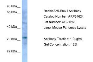 WB Suggested Anti-Emx1 Antibody   Titration: 1. (EMX1 antibody  (Middle Region))