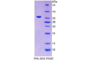 SDS-PAGE analysis of Guinea pig APOC2 Protein.
