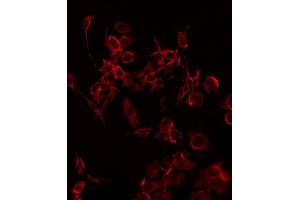 ABIN6268823 staining HuvEc by IF/ICC. (CD69 antibody  (Internal Region))