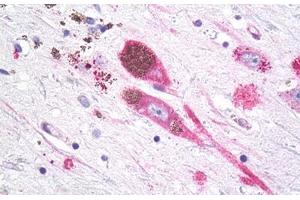 Anti-MC1R antibody IHC staining of brain, substantia nigra, neurons. (MC1 Receptor antibody  (Cytoplasmic Domain))