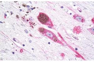 Anti-MC1R antibody IHC staining of brain, substantia nigra, neurons.