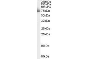 Western Blotting (WB) image for anti-Signal Transducer and Activator of Transcription 3 (Acute-Phase Response Factor) (STAT3) (Internal Region) antibody (ABIN2465310) (STAT3 antibody  (Internal Region))
