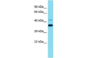 Host: Rabbit Target Name: CCDC137 Sample Type: Jurkat Whole Cell lysates Antibody Dilution: 1. (CCDC137 antibody  (N-Term))