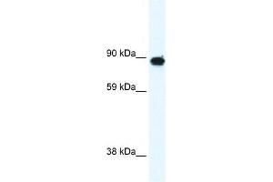 GRM6 antibody used at 0. (Metabotropic Glutamate Receptor 6 antibody  (C-Term))