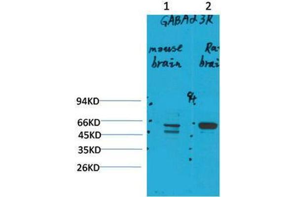 GABRA3 antibody